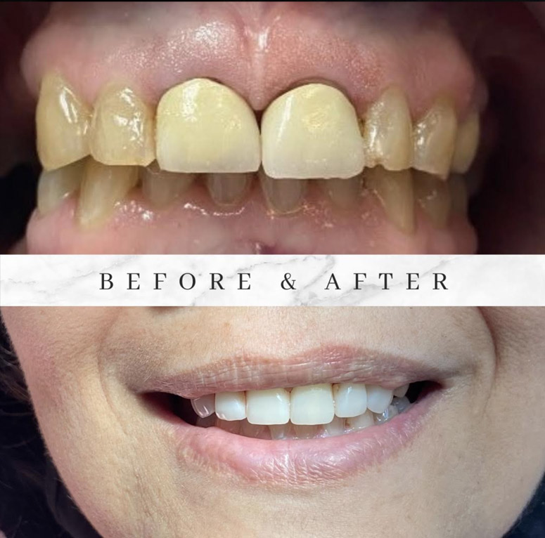 glendale dentist before after photo