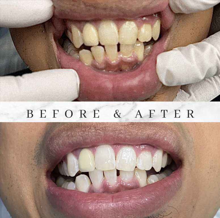 glendale dentist before after photo